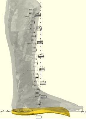 Measurement of shin with orthotic