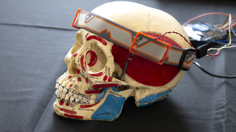 A skull model with a band wrapped around the head, demonstrating use of medical device