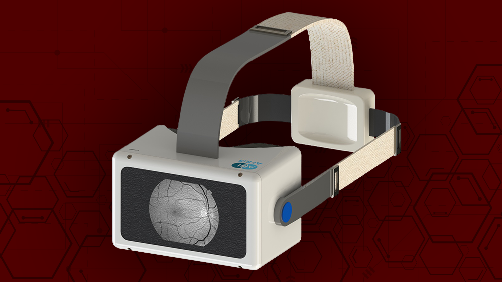 Ocular device used by Ai-Ris.