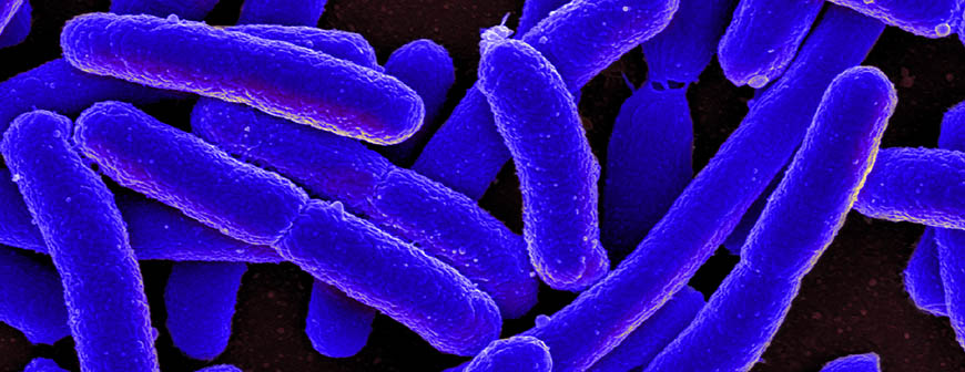 Close up picture of e.coli bacteria. They are blue, cylindrical shapes.