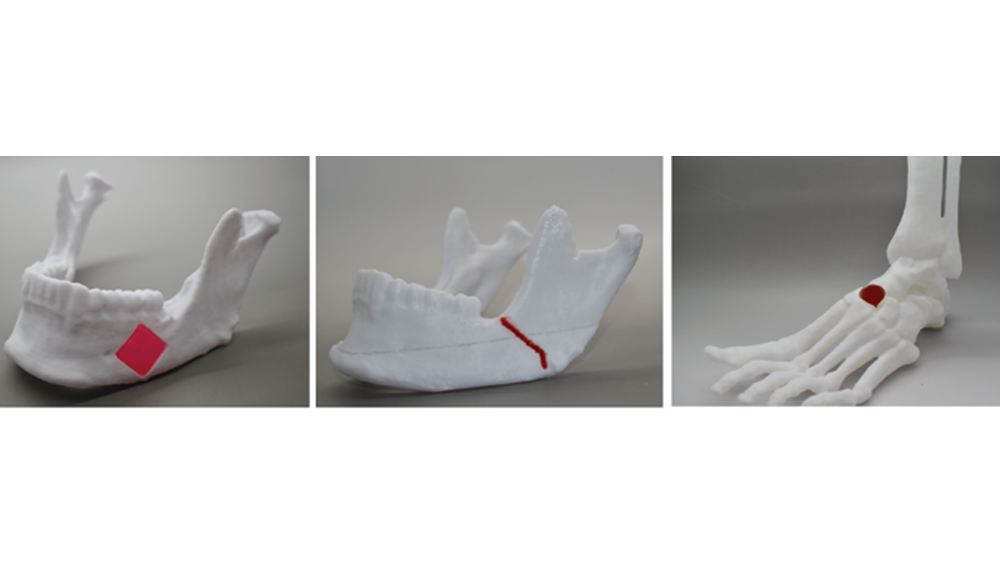3D bioprinted NICE scaffolds of jaw and photo