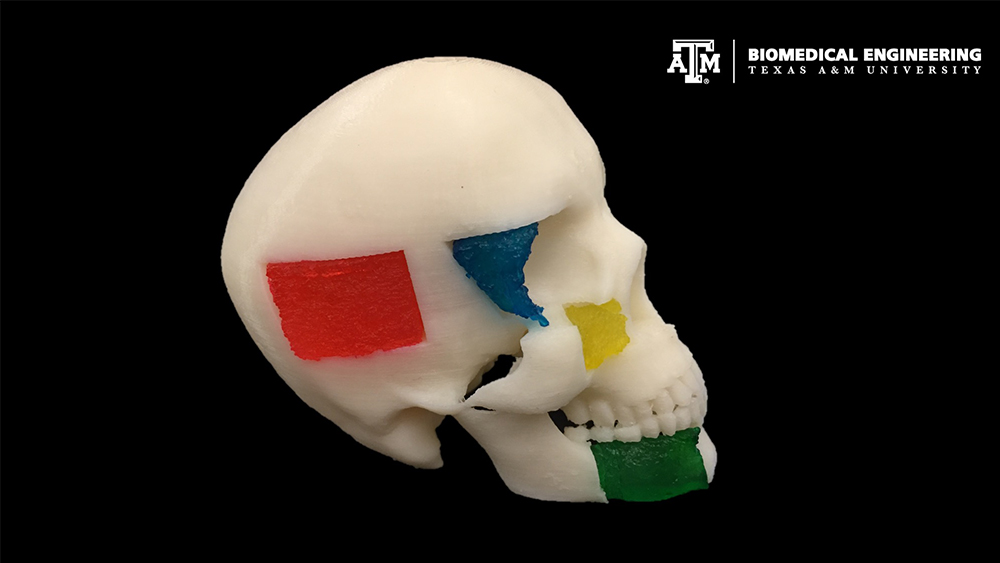 A plastic model of a skull showing how the NICE hydrogels can be inserted into the site of repair.