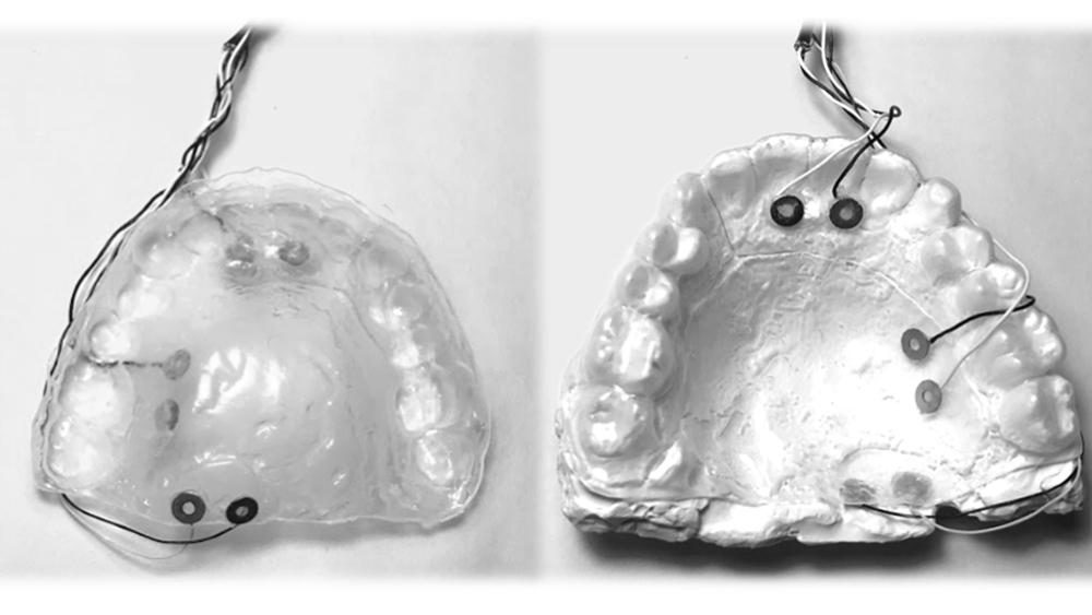 Top and bottom view of a retainer with stimulation electrode connection points