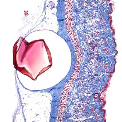 A cylindrical shaped cell under a microscope. On one side are small squares and rectangles dyed with blue and red ink. On the left is a large, heart shaped red piece of material.