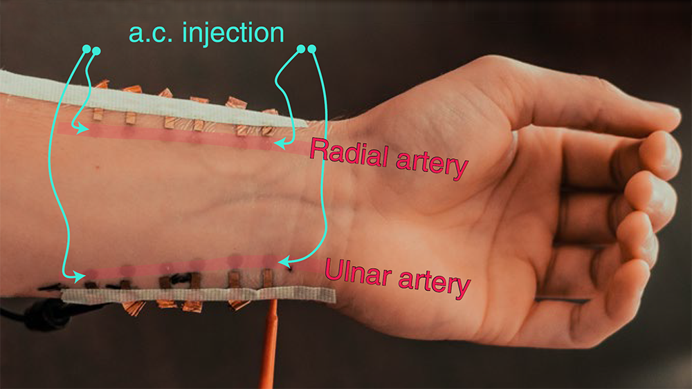 Graphene-based sensors are nearly invisible under the red markings, which are used to measure blood pressure. 