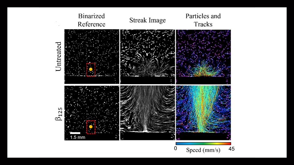 The figure shows the pathlines of seeded fluorescent particles in a binarized reference, streak image and particles and tracks measured in millimeters per second. This shows the dynamics following cavitation bubble collapses near an untreated polydimethylsiloxane surface and a treated microstructure surface.