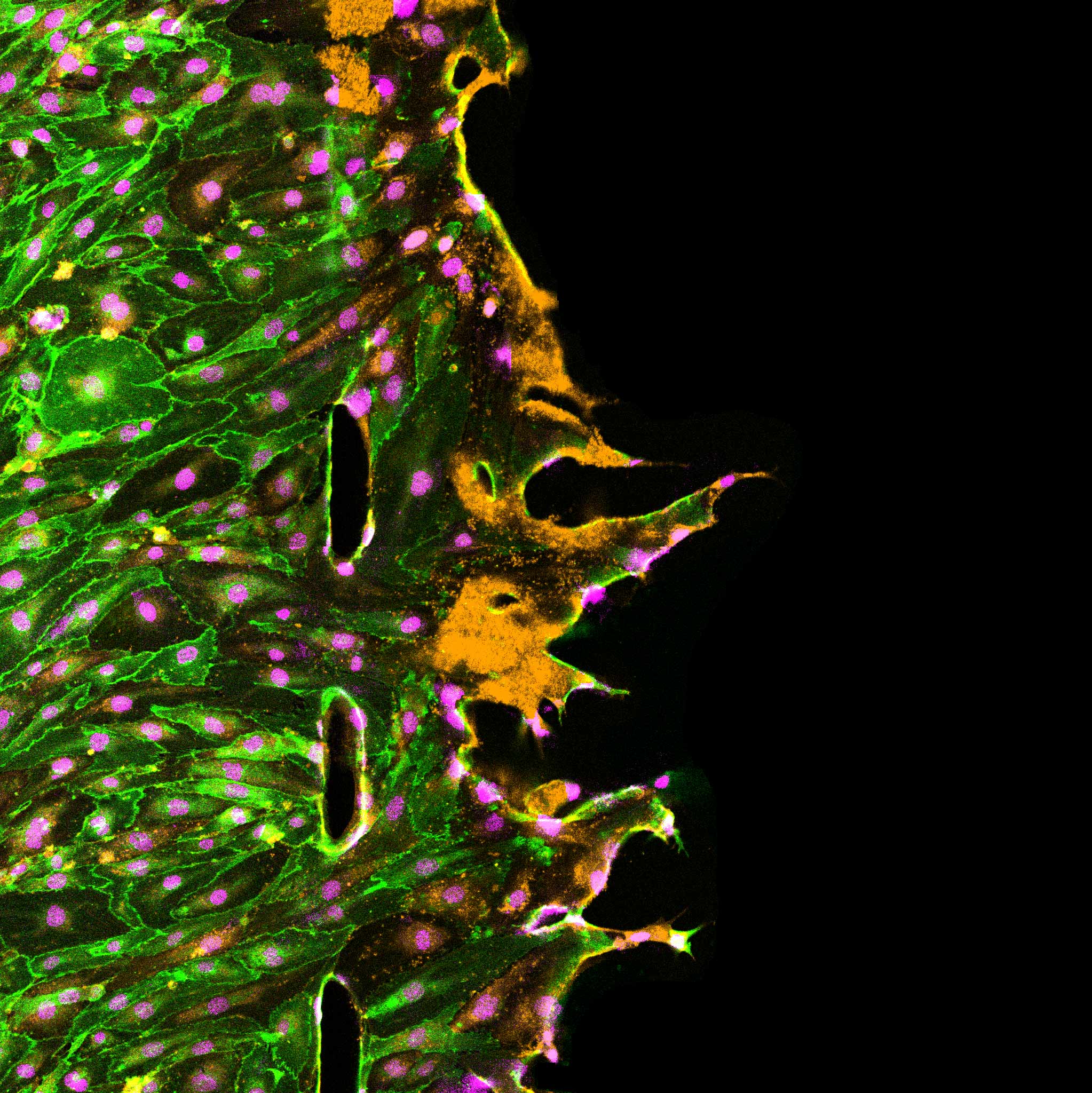 An artwork where new vessel sprouts from capillary, green endothelial cells and orange blood platelets.