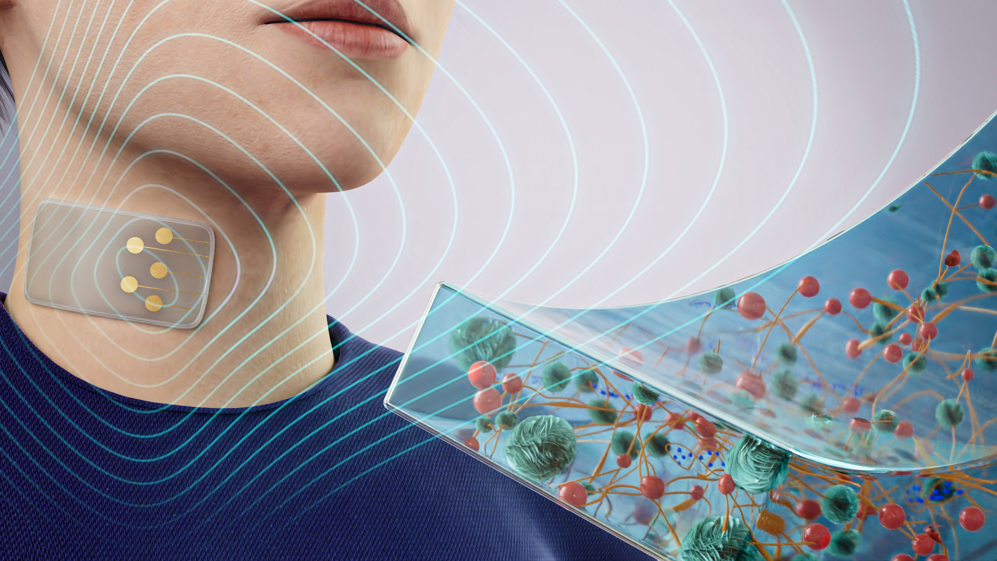 A patch of electronic skin on a human neck with a diagram of the nanoengineered hydrogels. 