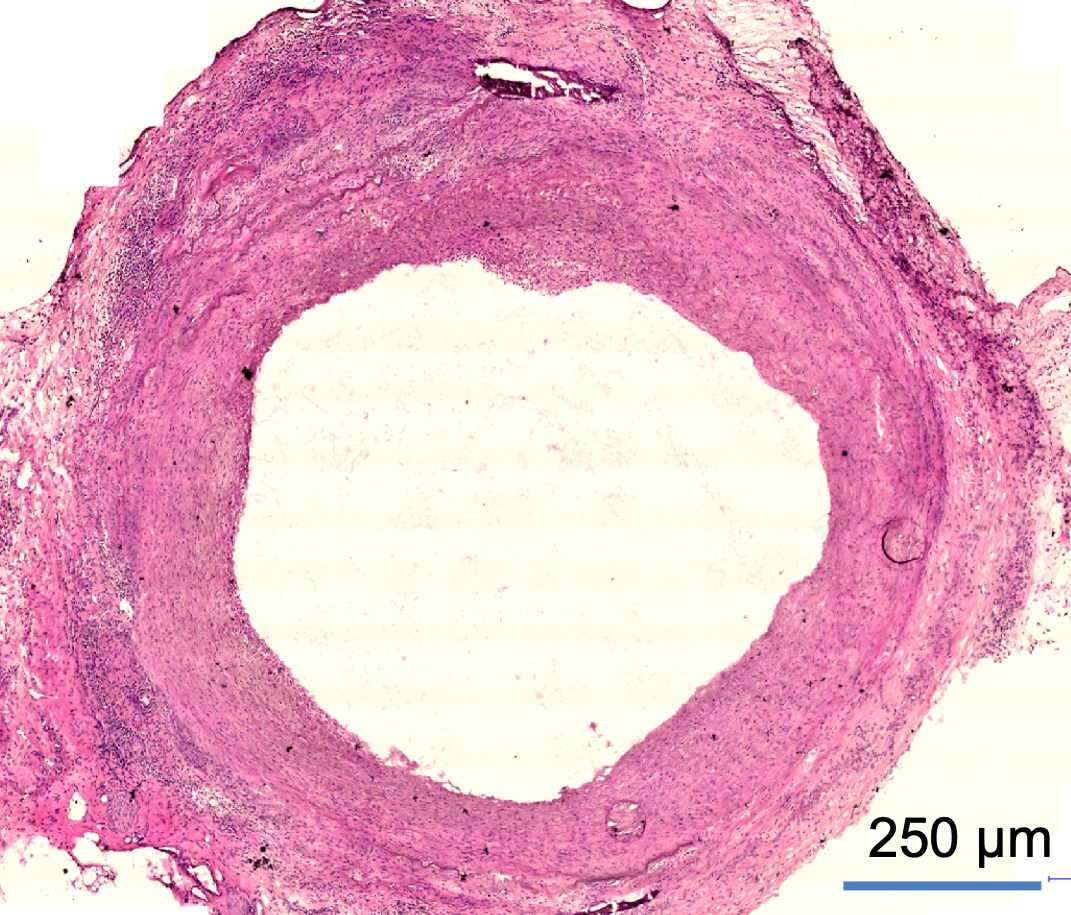 Pink circle of microscopic sample at 250 microns.