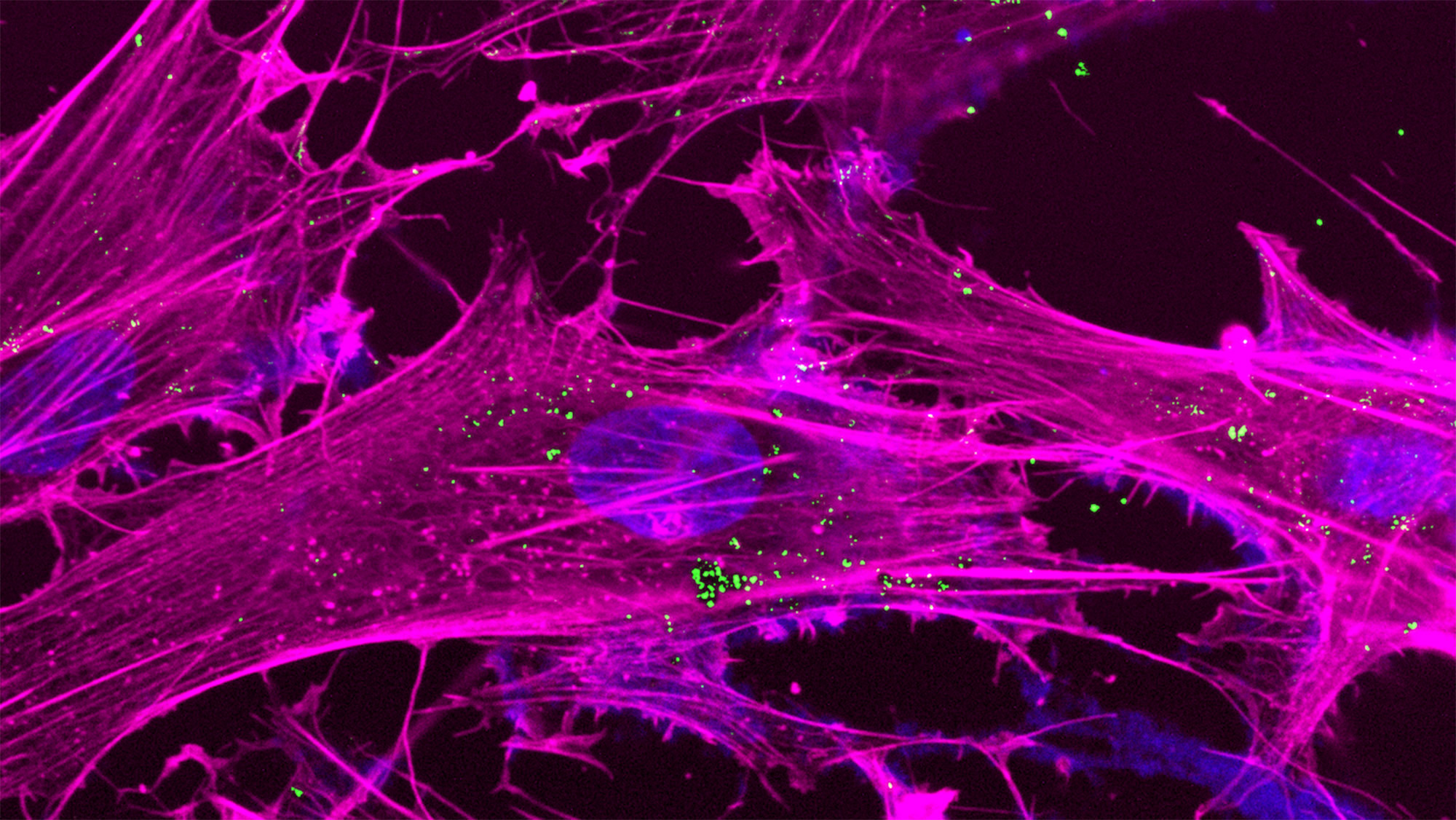 Purple webbed cells with a blue circular nucleus and tiny green particles sprinkled around the cell.