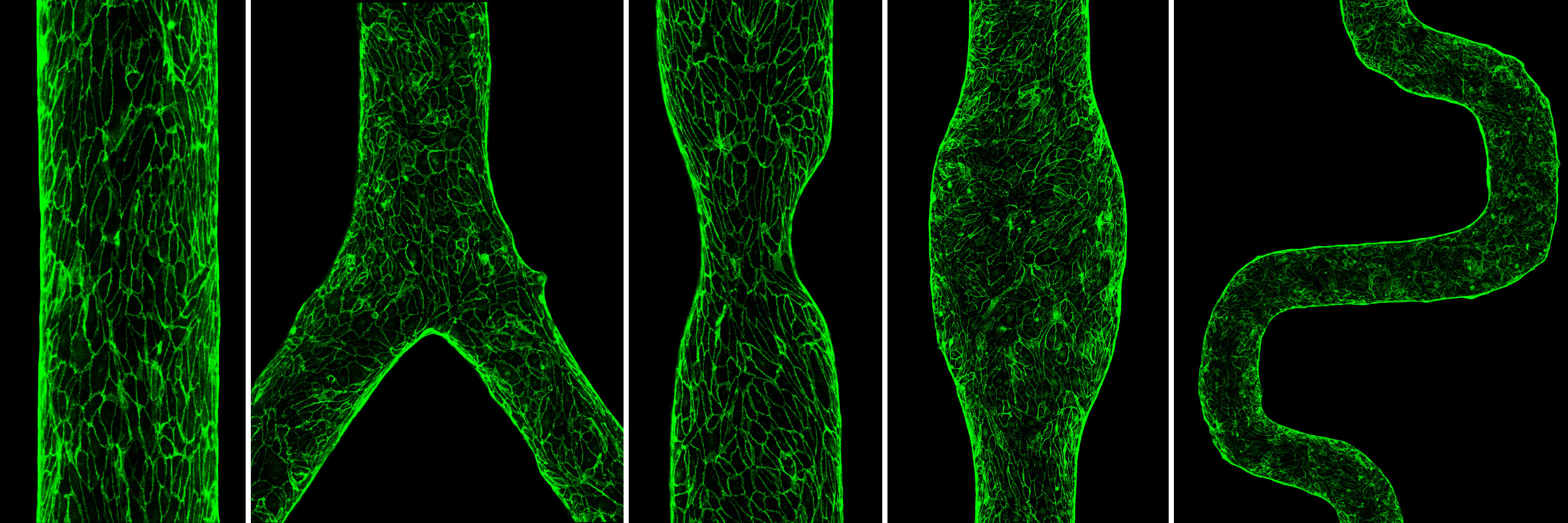 Green-stained blood vessel cells.